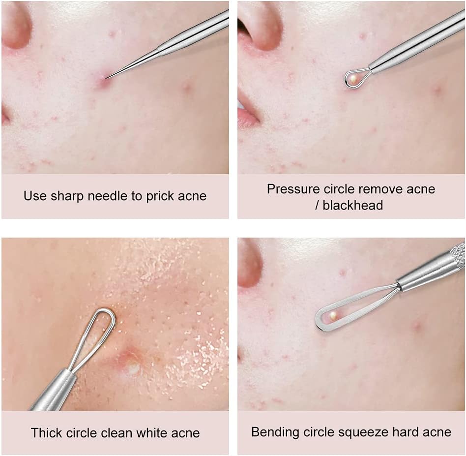 Magic Collection® Blackhead Remover, 2 PCS Pimple Popper ,Stainless Steel Pimple Extractor