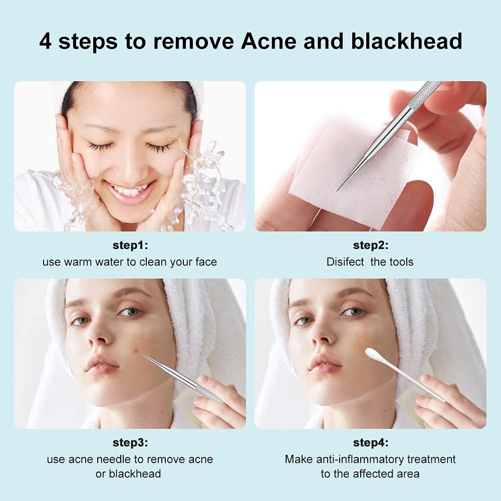 Magic Collection® Blackhead Remover, 2 PCS Pimple Popper ,Stainless Steel Pimple Extractor